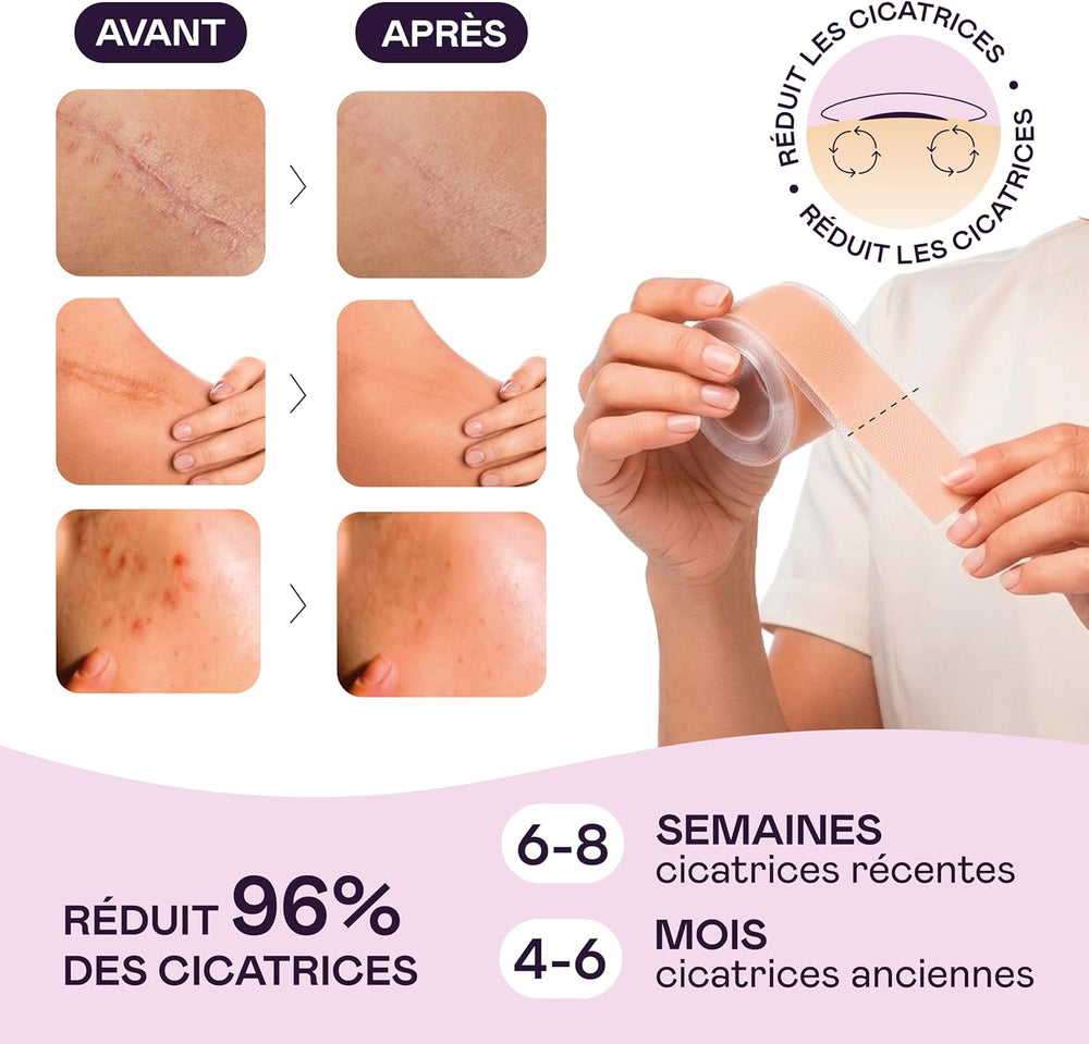 Rouleau Pansement Silicone